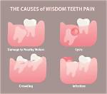 Do Wisdom Teeth Hurt?