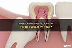 Do Wisdom Teeth Stop Growing?