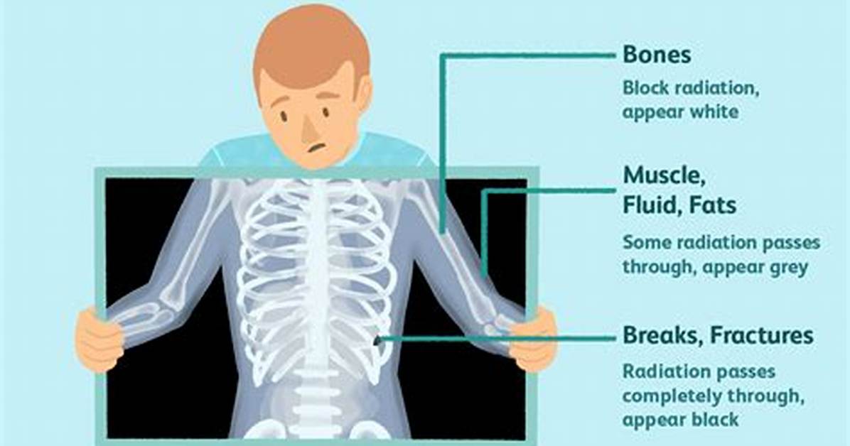 Do X Rays Hurt?