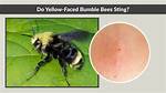 Do Yellow Bumble Bees Sting?