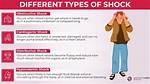 Do You Shock Afib