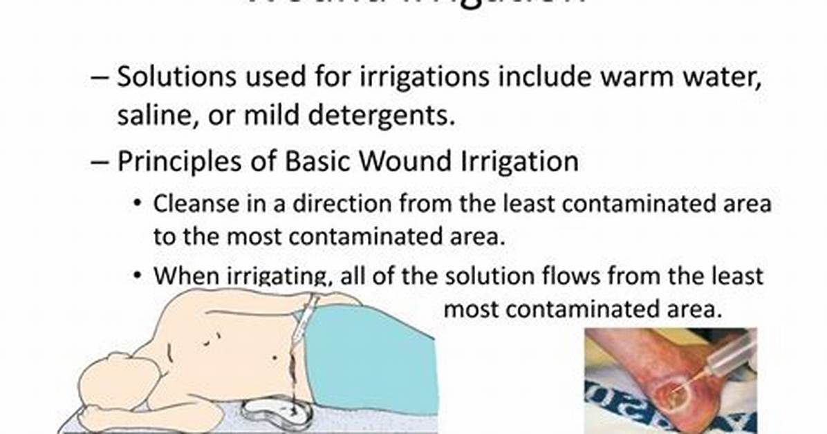 Do You Warm Irrigating Solution?