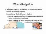 Do You Warm Irrigating Solution?