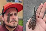 Dobsonfly Bite