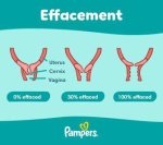 Does 80 Effaced Mean Anything?