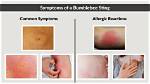 Does a Bumblebee Sting Hurt?