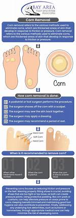 Does a Corn Fall off?