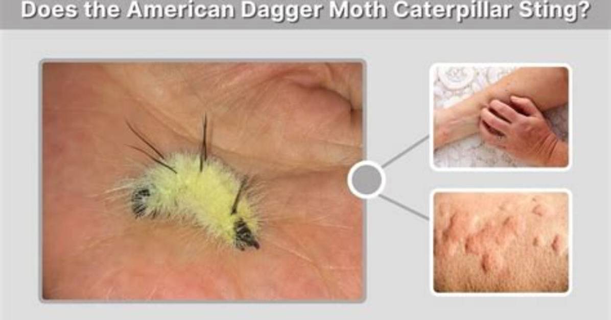 Does a Dagger Moth Sting