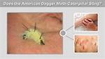 Does a Dagger Moth Sting