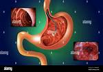 Does a Gastroscopy Hurt?
