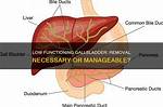 Does a Low Functioning Gallbladder Need to Be Removed