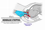 Does a Membrane Sweep Work