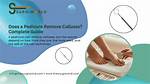 Does a Pedicure Remove Calluses?