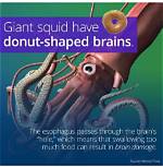 Does a Squid Have a Brain?