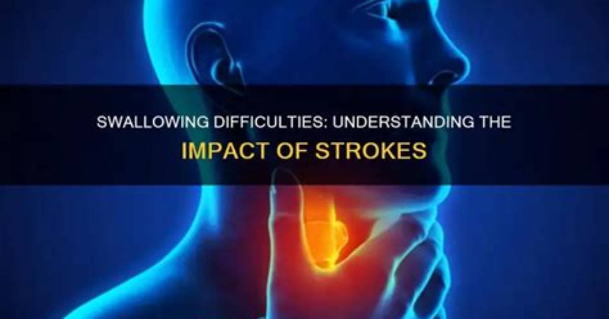 Does a Stroke Affect Swallowing?
