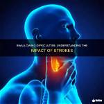 Does a Stroke Affect Swallowing?