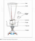 Does a Tonometer Touch Your Eye?