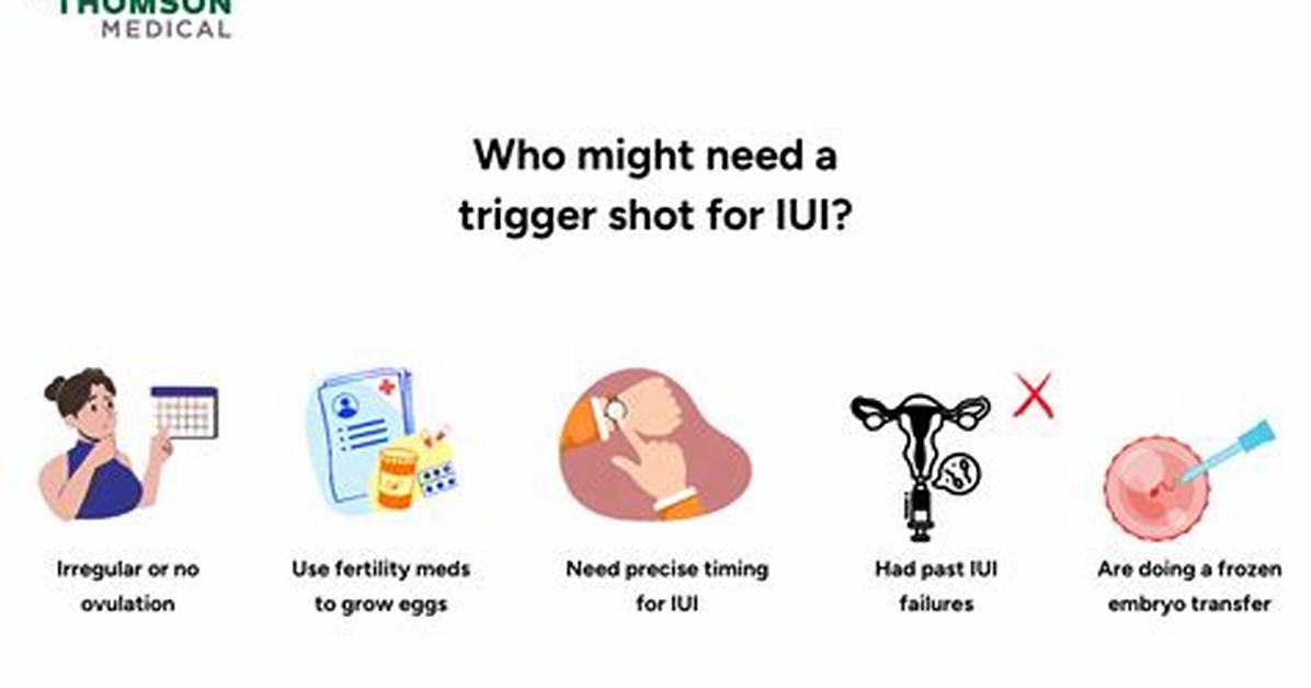 Does a Trigger Shot Guarantee Ovulation?