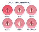 Does a Videostroboscopy Hurt?