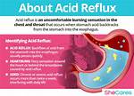 Does Actonel Cause Acid Reflux?