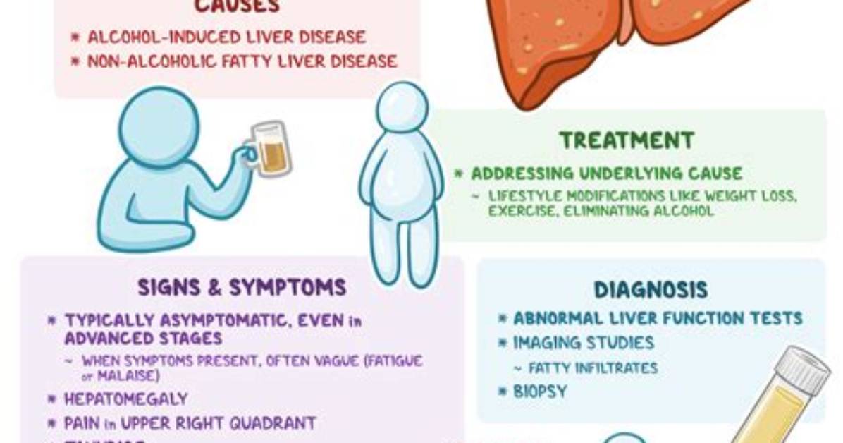 Does Alcohol Cause Pbc?