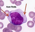 Does All Have Auer Rods?