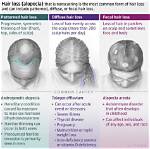 Does Alopecia Spread Quickly?