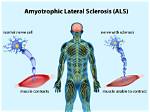 Does Als Start on One Side