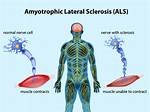 Does Als Start Unilaterally?