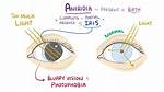 Does Aniridia Cause Blindness?