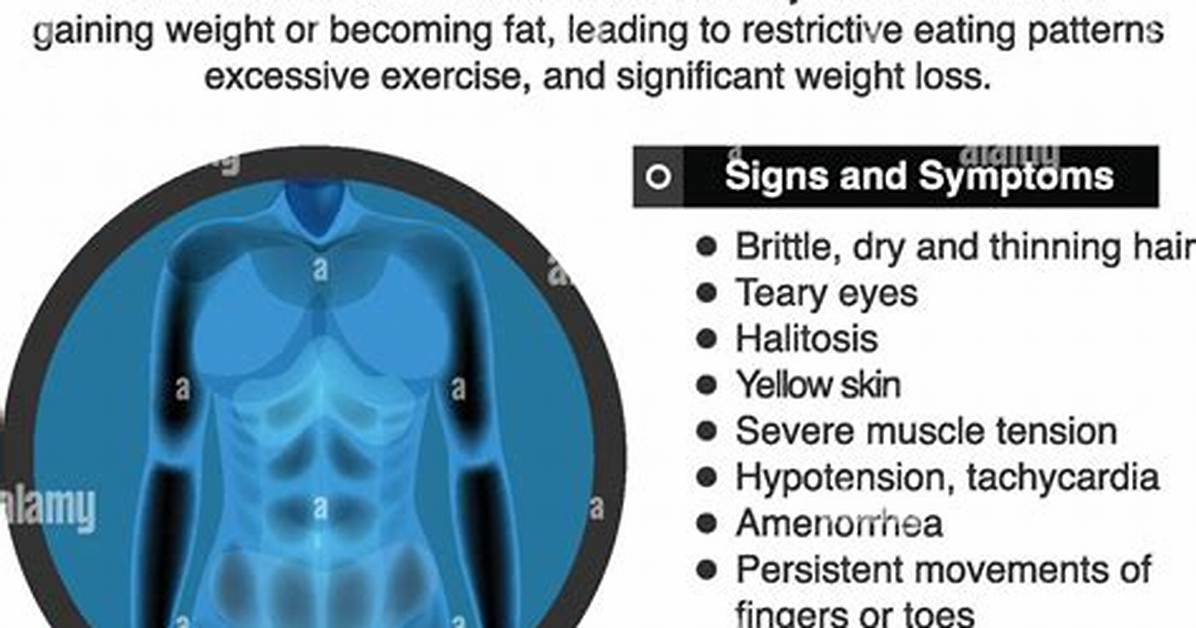 Does Anorexia Cause Bruising?