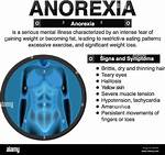 Does Anorexia Cause Bruising?