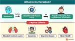 Does Anxiety Cause Rumination?