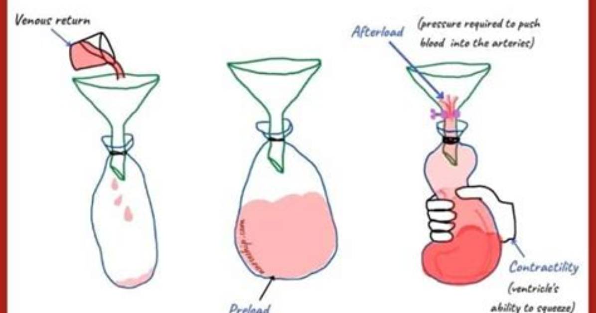 Does Arteriole Constriction Increase Afterload?