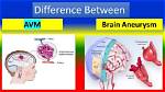 Does Avm Cause Aneurysm?