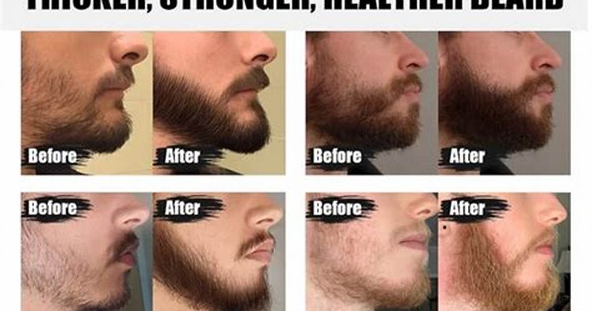 Does Beard Thickener Work?