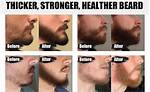 Does Beard Thickener Work?