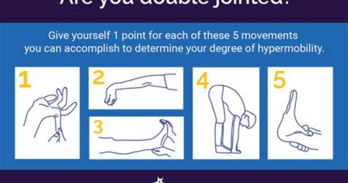 Does Being Double Jointed Cause Problems?