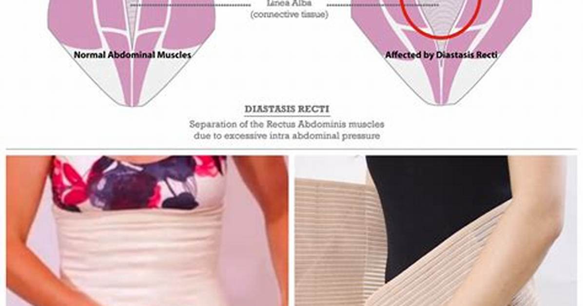Does Belly Binding Work?