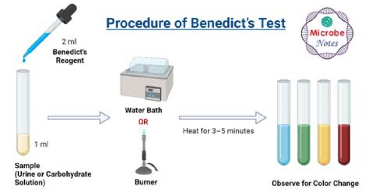 Does Benedict's Test Require Heat?