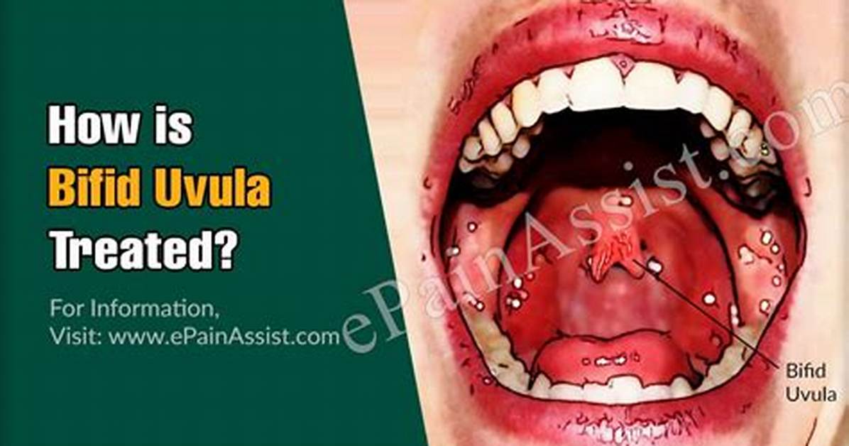 Does Bifid Uvula Affect Speech?