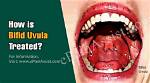 Does Bifid Uvula Affect Speech?