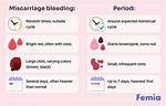 Does Bleeding Always Mean Miscarriage?