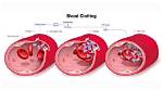 Does Blood Clots Move?