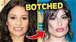 Does Botched Pay for Your Surgery?