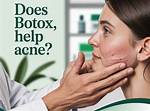 Does Botox Help Acne?