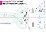 Does Botulinum Cause Lockjaw?