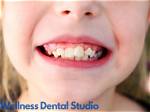 Does Buck Teeth Affect Speech?