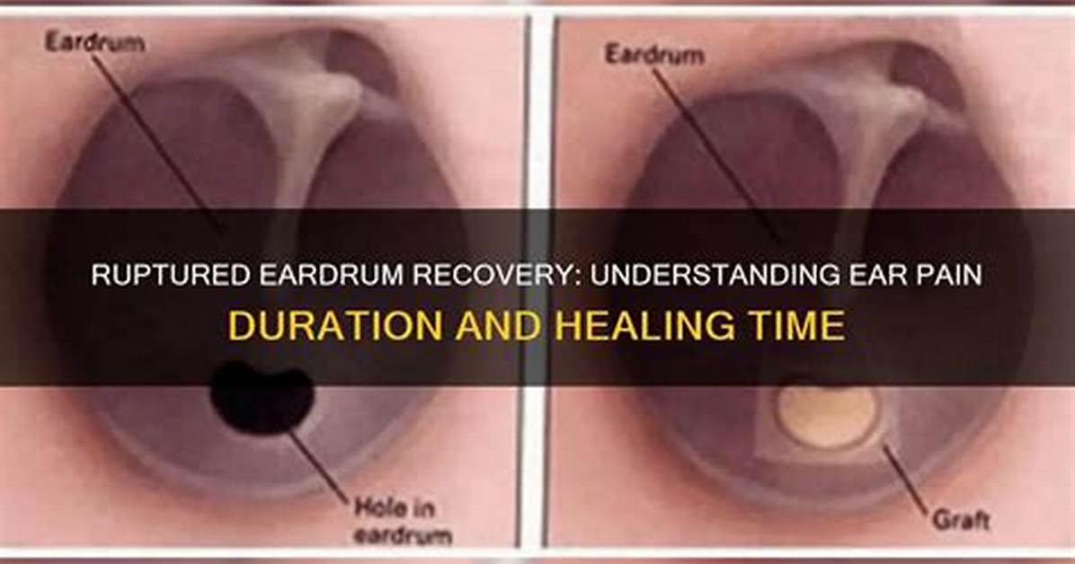 Does Burst Eardrum Heal?