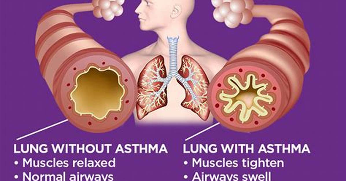 Does Caffeine Make Asthma Worse?